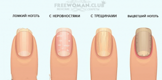 Проблемы с ногтями на руках. О чем предупреждают ваши ногти