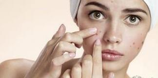 Уход за проблемной кожей лица: правила и советы